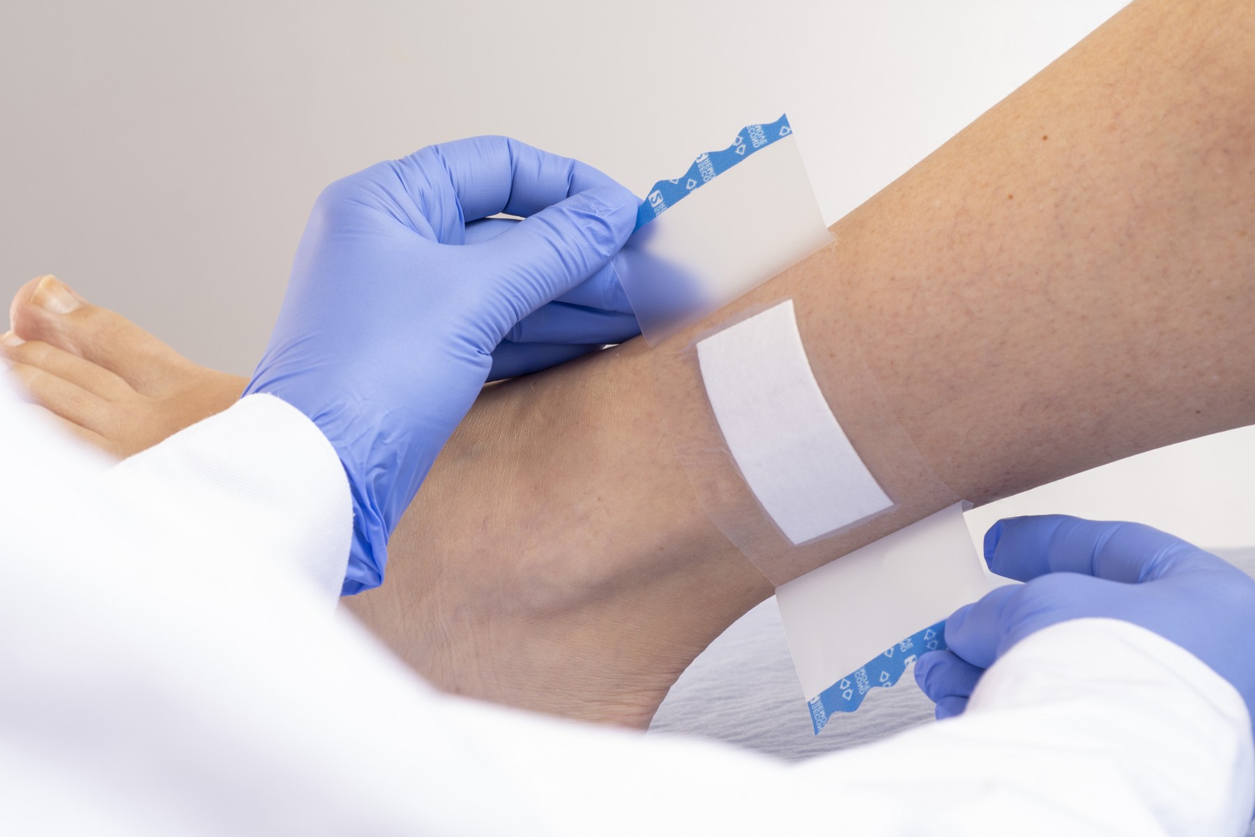 科思创利用PP和TPU材料，开发新的伤口敷料解决方案