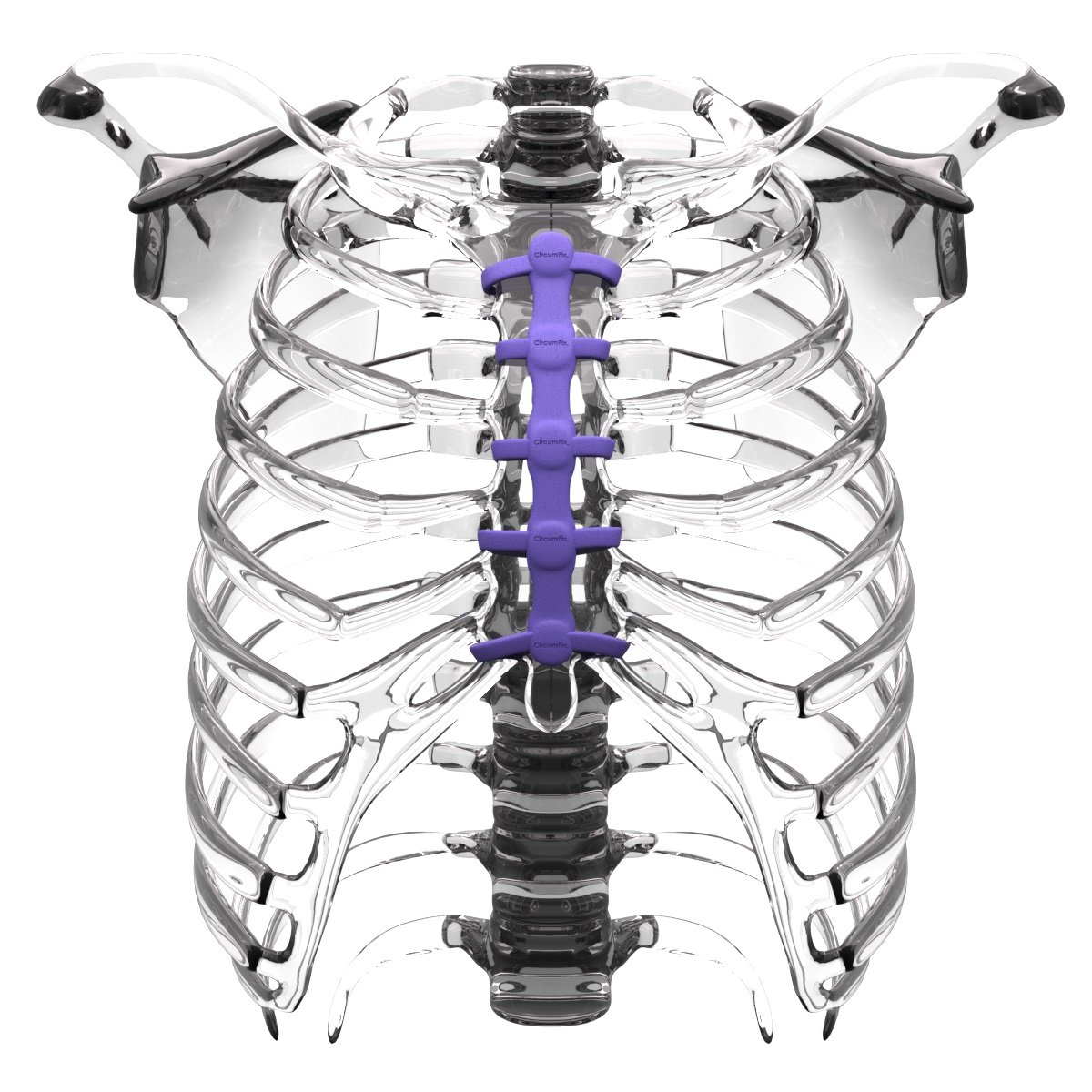 赢创投资美国医疗器械初创企业，为开胸手术患者提供更好的术